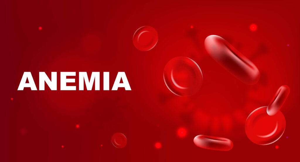 Anemia: Symptoms, Causes, Diagnosis - Haemato Oncology Care Centre